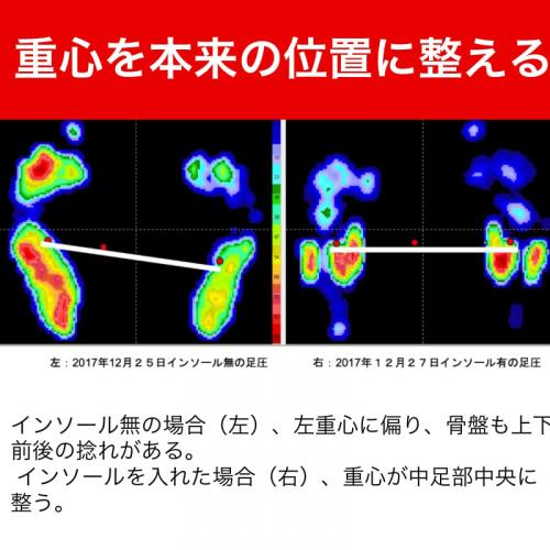 sky2様　24cm2点　25cm2点　4点セット　イレルダケ　インソール sky2様 24cm2点 25cm2点 4点セット イレルダケ インソール top.jpg